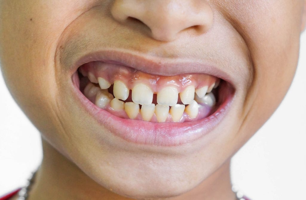 Dental Smile
