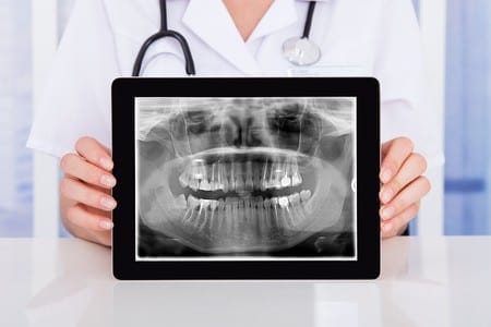 digital dental xray