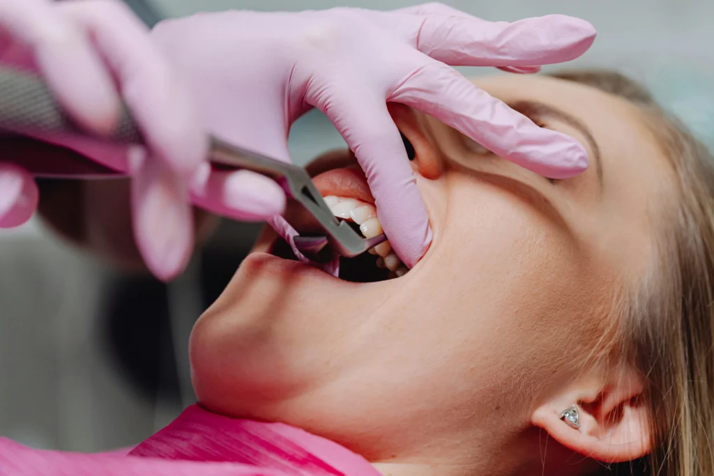 Common inclusions in dental hygiene services concord nc