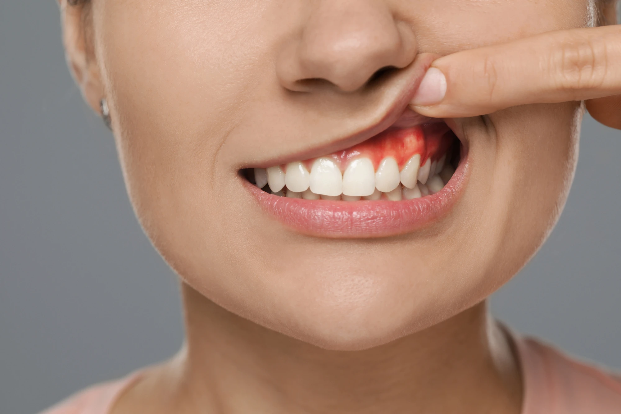 All about Gum Health & Preventive Care With a Dentist in Park Road