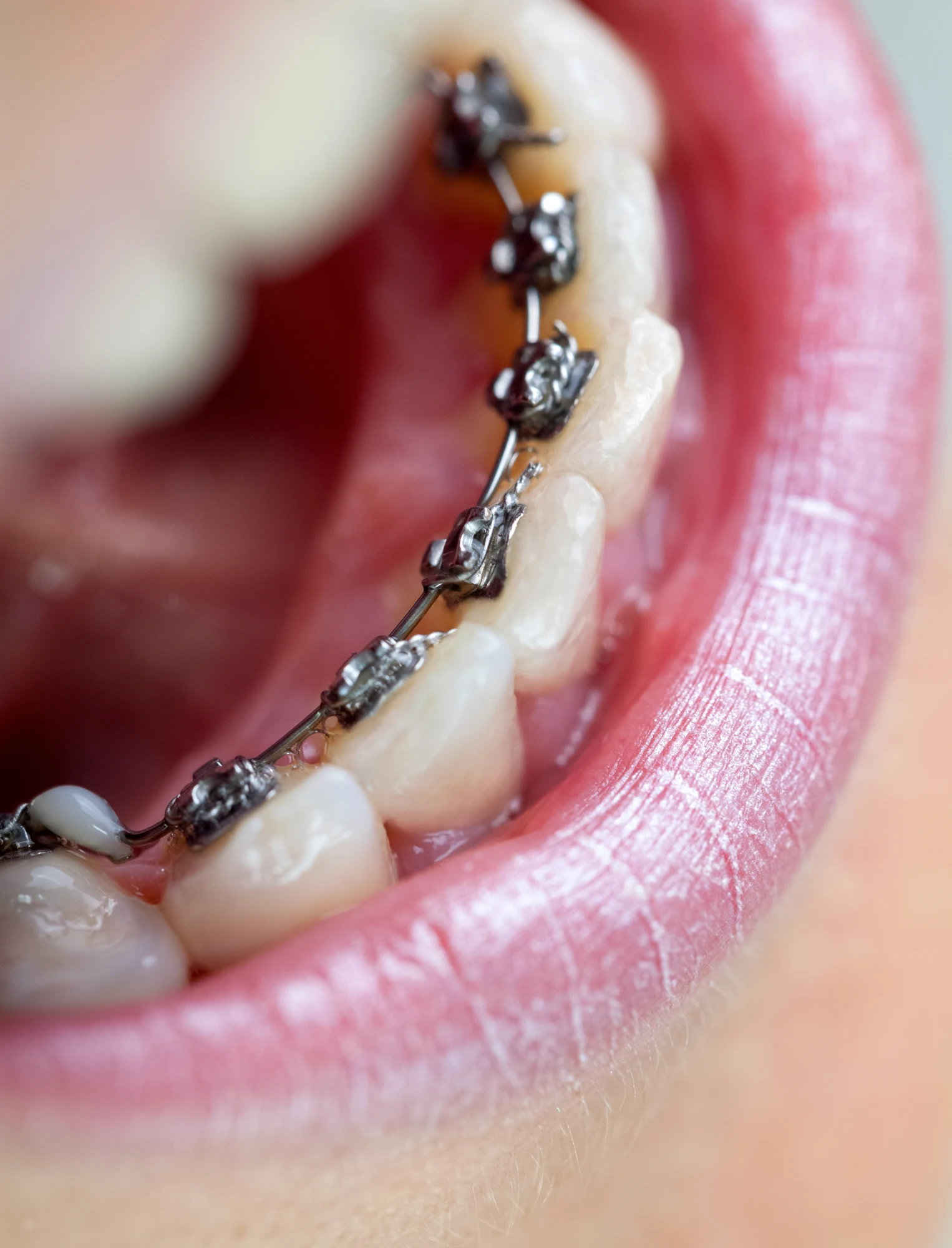 Cosmetic & restorative expertise by a dentist in Harrisburg, NC