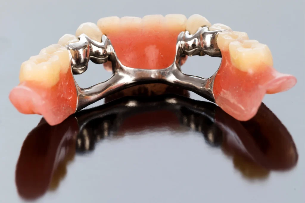 Getting-dental-crowns-in-Harrisburg-NC