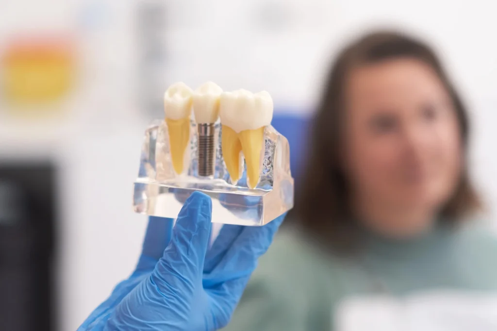 Which should you get- a single or a full dental implants in Harrisburg, NC