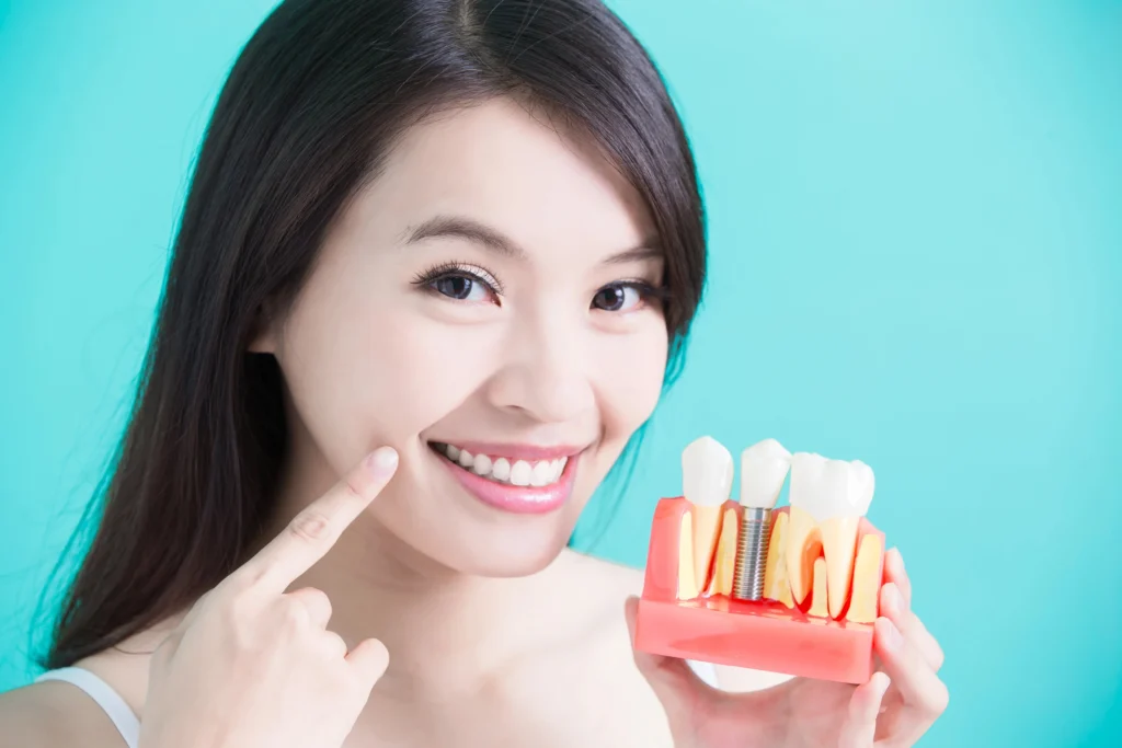dental implant options