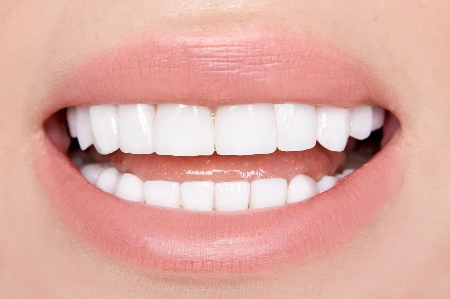 close-up-teeth-whitening-sessions