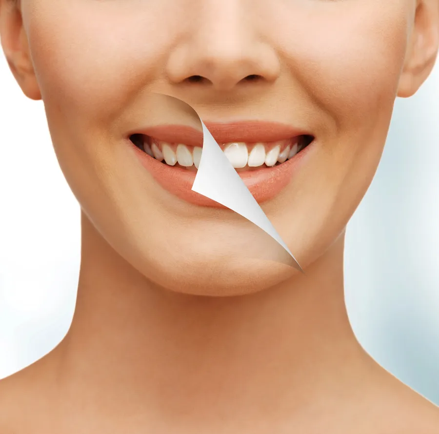 teeth whitening hickory nc effect revealed smile