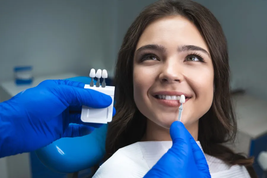 whitening-teeth-shade-comparison