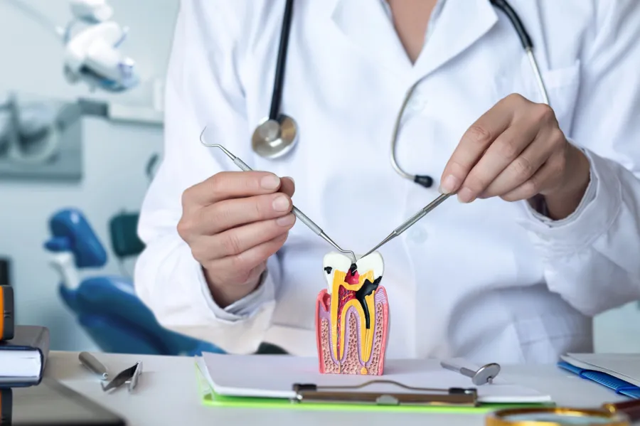wisdom tooth extraction harrisburg nc model illustration