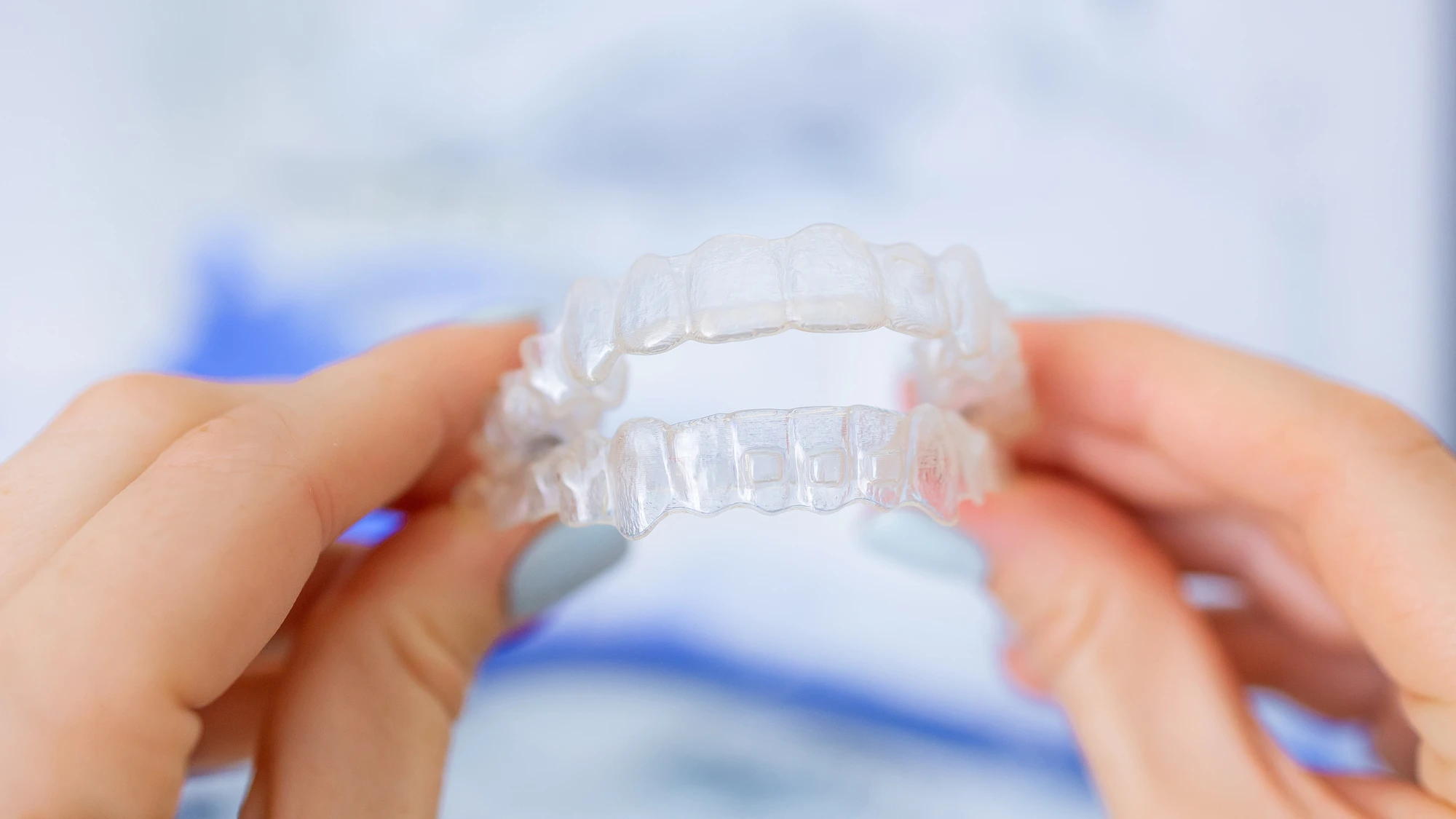 clear aligners gastonia orthodontic trays closeup