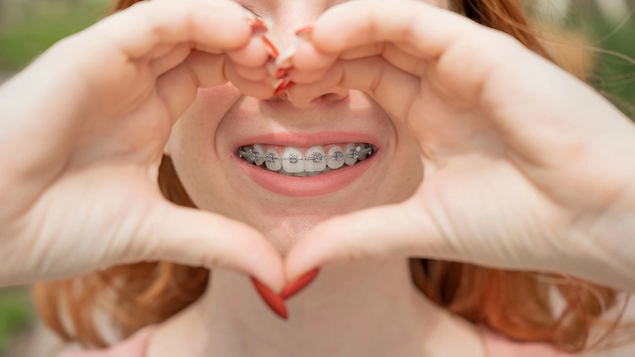 dental braces concord nc smile with braces heart hands