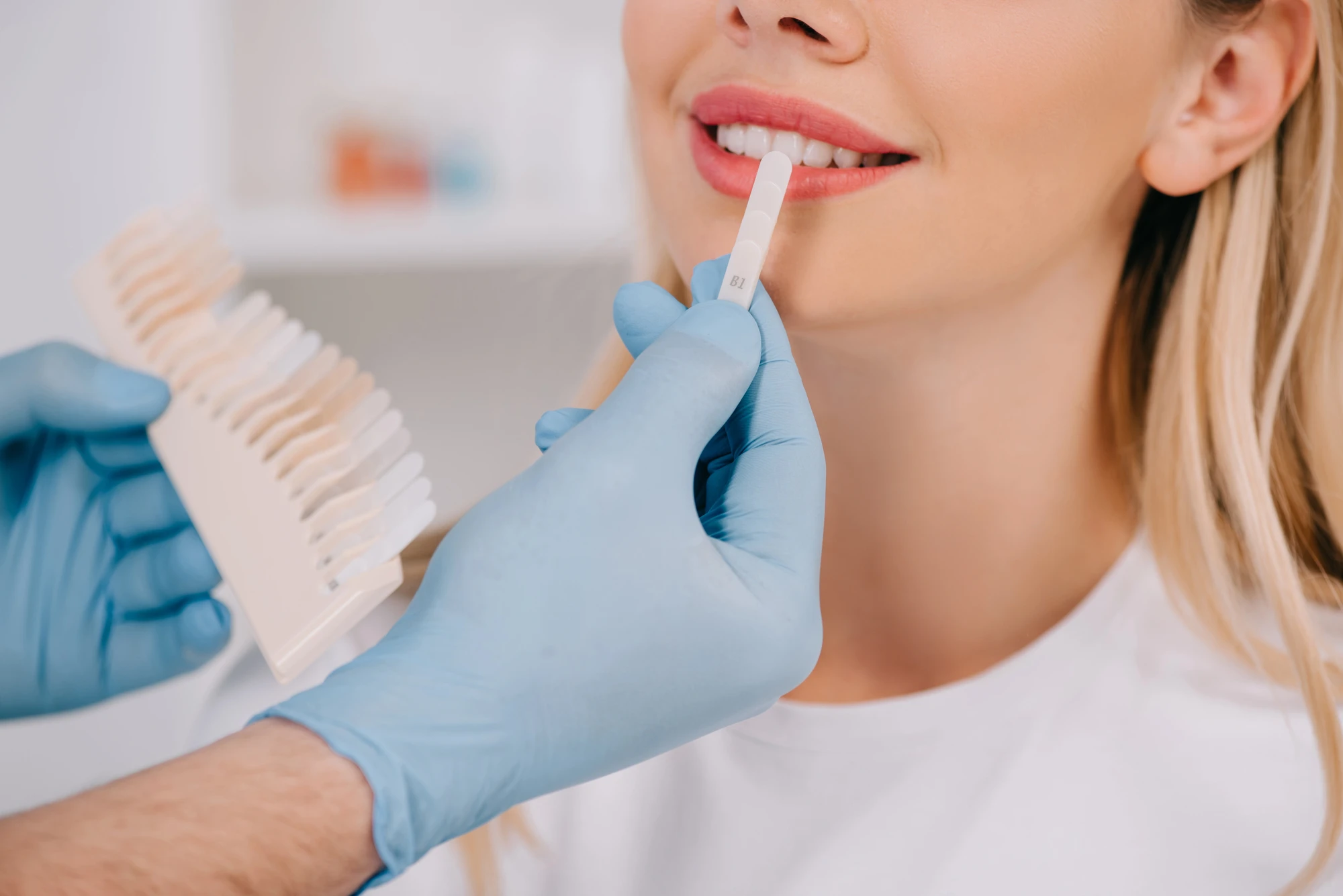 teeth whitening concord nc tooth shade matching closeup