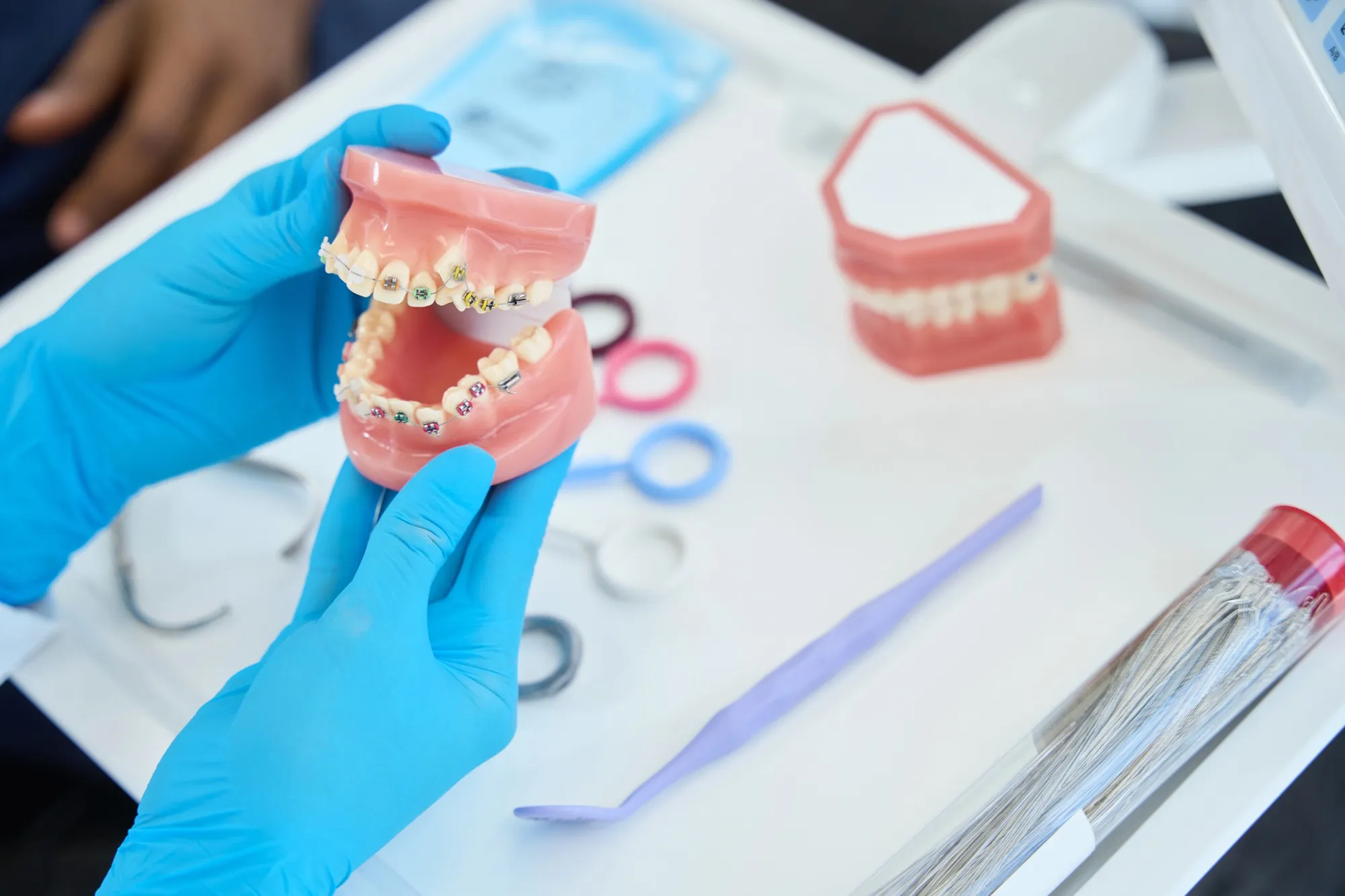 affordable braces hickory nc orthodontic braces model