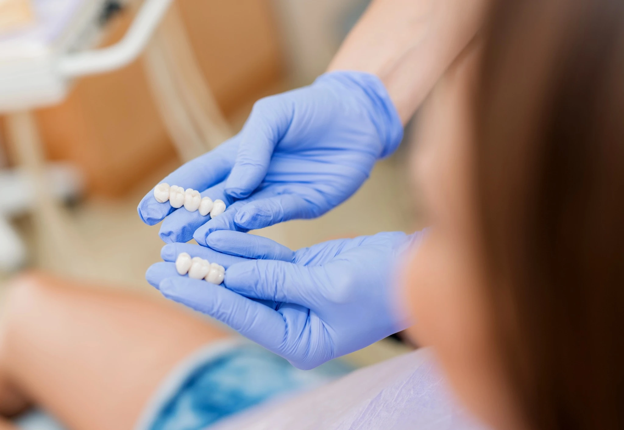 veneers-huntersville-nc-veneer-consultation