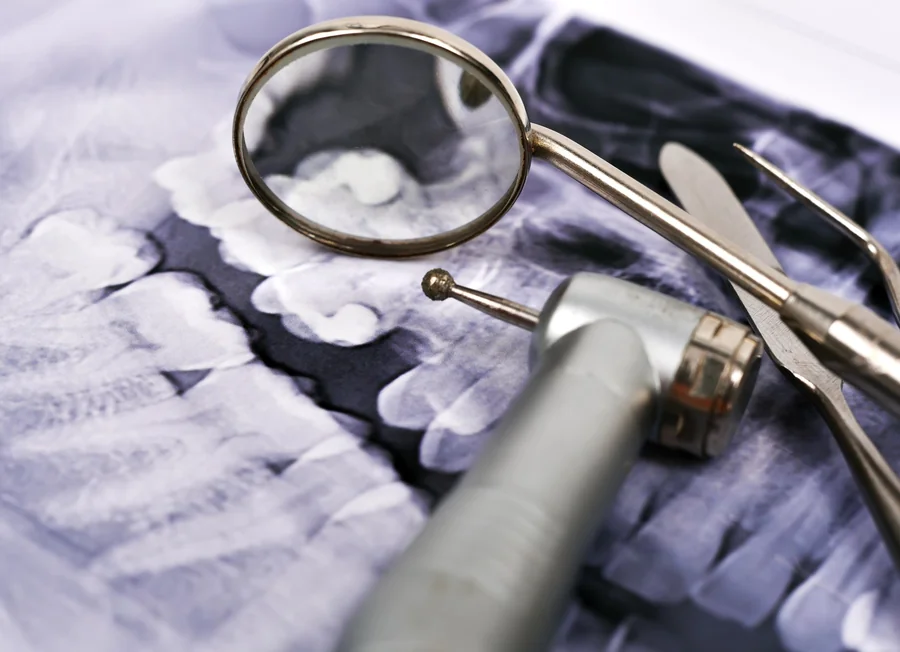 digital-dental-xray-tools-at-dentist-office-gastonia-nc-for-accurate-diagnosis