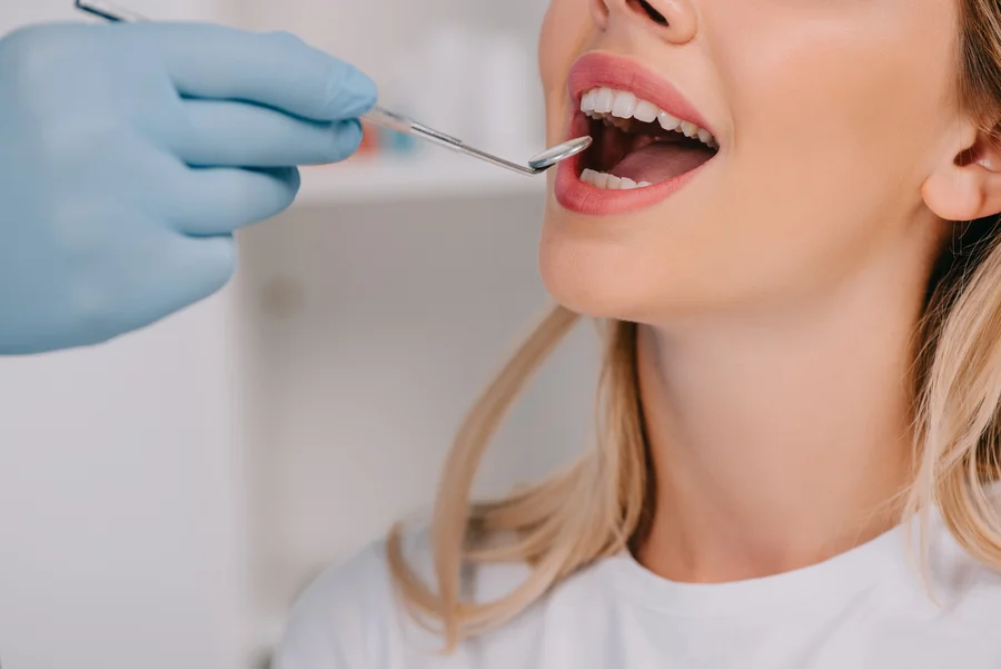 dental-hygiene-services-in-concord-nc-closeup-of-dental-checkup