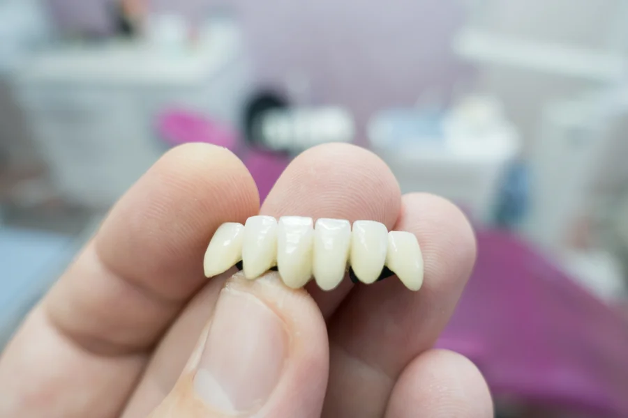 dental crowns harrisburg nc hand holding porcelain crown bridge